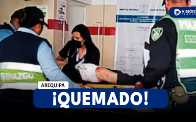 AREQUIPA: ALBAÑIL TERMINÓ CON QUEMADURAS DE TERCER GRADO EN LAS PIERNAS CUANDO LIBABA LICOR CON SUS AMIGOS