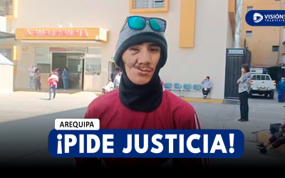 AREQUIPA: JOVEN PIDE JUSTICIA TRAS DOS MESES DE HABER SIDO ATACADO Y CONTINÚA CON EL ROSTRO DESFIGURADO