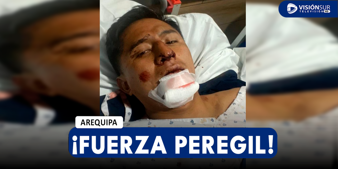 AREQUIPA: TIKTOKER PEREGIL SUFRE FUERTE ACCIDENTE MANEJANDO SU MOTO Y TERMINA CON EL FÉMUR Y LA NARIZ ROTA