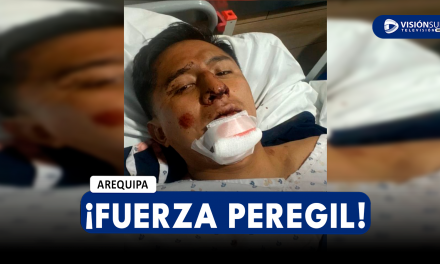 AREQUIPA: TIKTOKER PEREGIL SUFRE FUERTE ACCIDENTE MANEJANDO SU MOTO Y TERMINA CON EL FÉMUR Y LA NARIZ ROTA