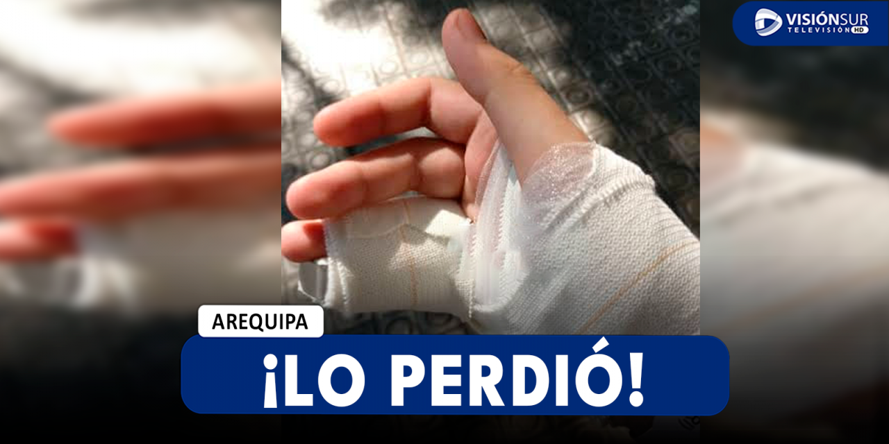 AREQUIPA: MENOR DE 17 AÑOS PIERDE UN DEDO DE SU MANO IZQUIERDA MIENTRAS LIMPIABA UNA COMPRESORA DE AIRE