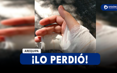 AREQUIPA: MENOR DE 17 AÑOS PIERDE UN DEDO DE SU MANO IZQUIERDA MIENTRAS LIMPIABA UNA COMPRESORA DE AIRE