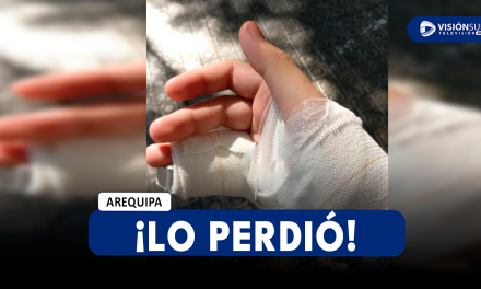 AREQUIPA: MENOR DE 17 AÑOS PIERDE UN DEDO DE SU MANO IZQUIERDA MIENTRAS LIMPIABA UNA COMPRESORA DE AIRE