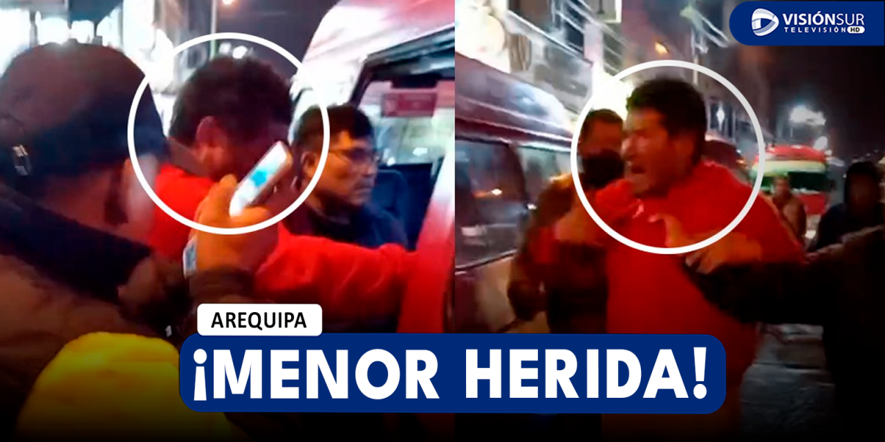 AREQUIPA: MENOR DE EDAD TERMINA CON EL ROSTRO DESFIGURADO TRAS CAERLE VIDRIOS DE UNA VENTANA QUE FUE ROTA EN BUS