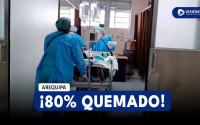 AREQUIPA: JOVEN DE 24 AÑOS TERMINA CON EL 80% DE SU CUERPO QUEMADO TRAS INICIAR INCENDIO EN MAJES