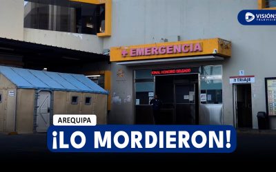 AREQUIPA: JOVEN ES MORDIDO POR DELINCUENTES PARA ROBARLE SUS PERTENENCIAS EN SOCABAYA