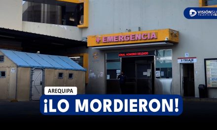 AREQUIPA: JOVEN ES MORDIDO POR DELINCUENTES PARA ROBARLE SUS PERTENENCIAS EN SOCABAYA