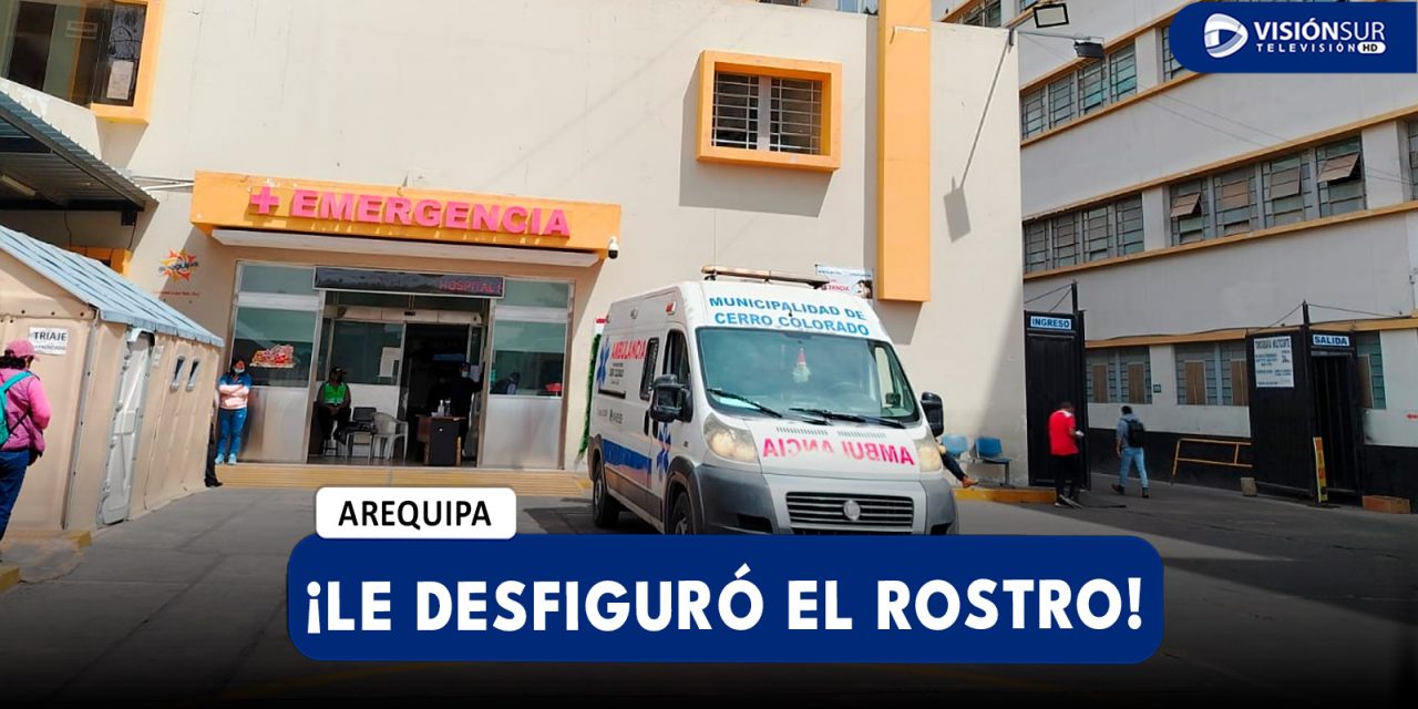 AREQUIPA: JOVEN ESTILISTA Y ATACADA POR SU PAREJA Y EL PRIMO DE ESTE DEJÁNDOLA CON EL ROSTRO DESFIGURADO