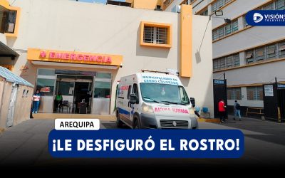 AREQUIPA: JOVEN ESTILISTA Y ATACADA POR SU PAREJA Y EL PRIMO DE ESTE DEJÁNDOLA CON EL ROSTRO DESFIGURADO