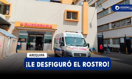 AREQUIPA: JOVEN ESTILISTA Y ATACADA POR SU PAREJA Y EL PRIMO DE ESTE DEJÁNDOLA CON EL ROSTRO DESFIGURADO