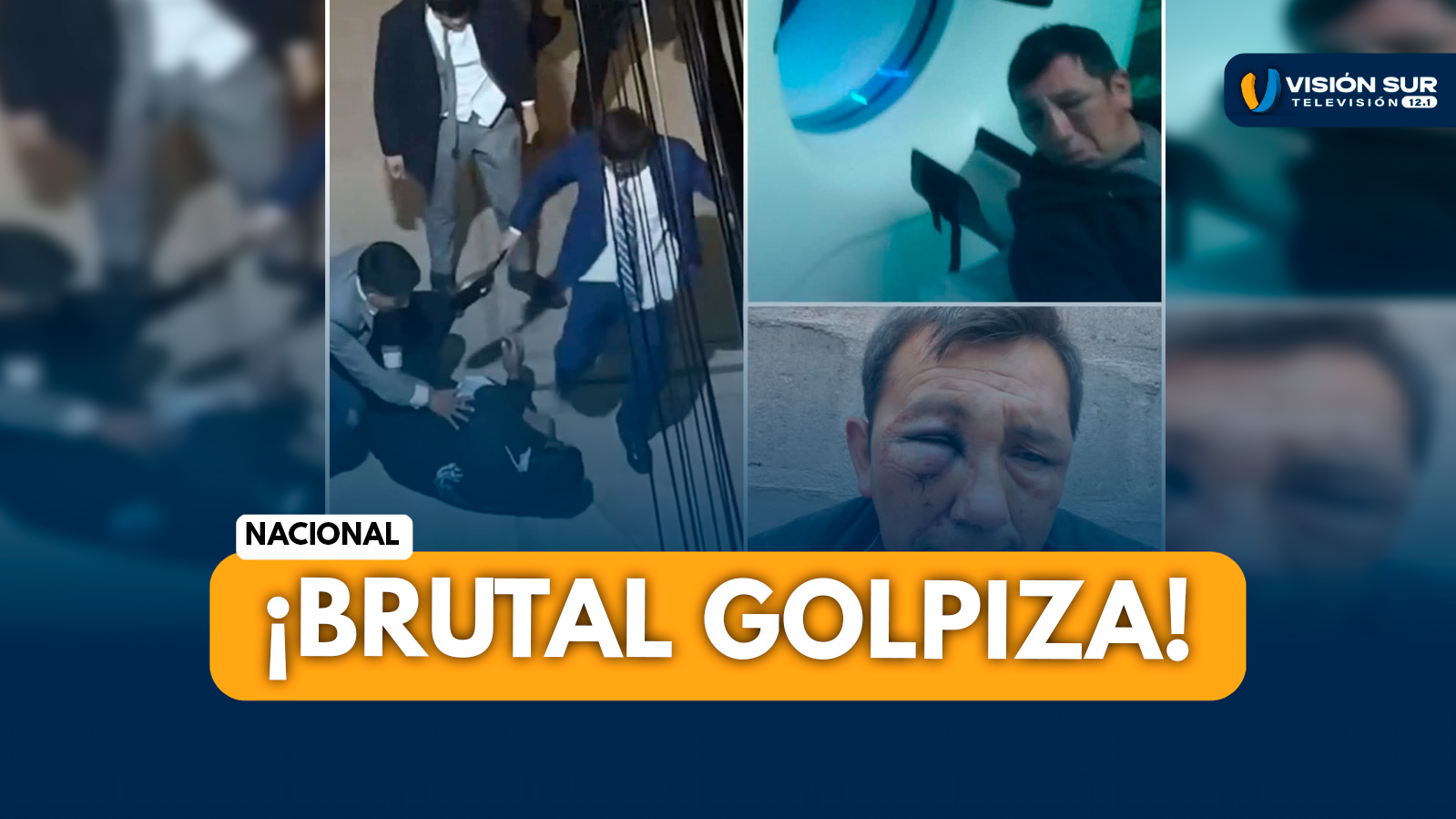 NACIONAL: AGENTE DE SEGURIDAD QUEDA GRAVE TRAS BRUTAL GOLPIZA DE SUJETOS EBRIOS EN LOCAL DE EVENTOS