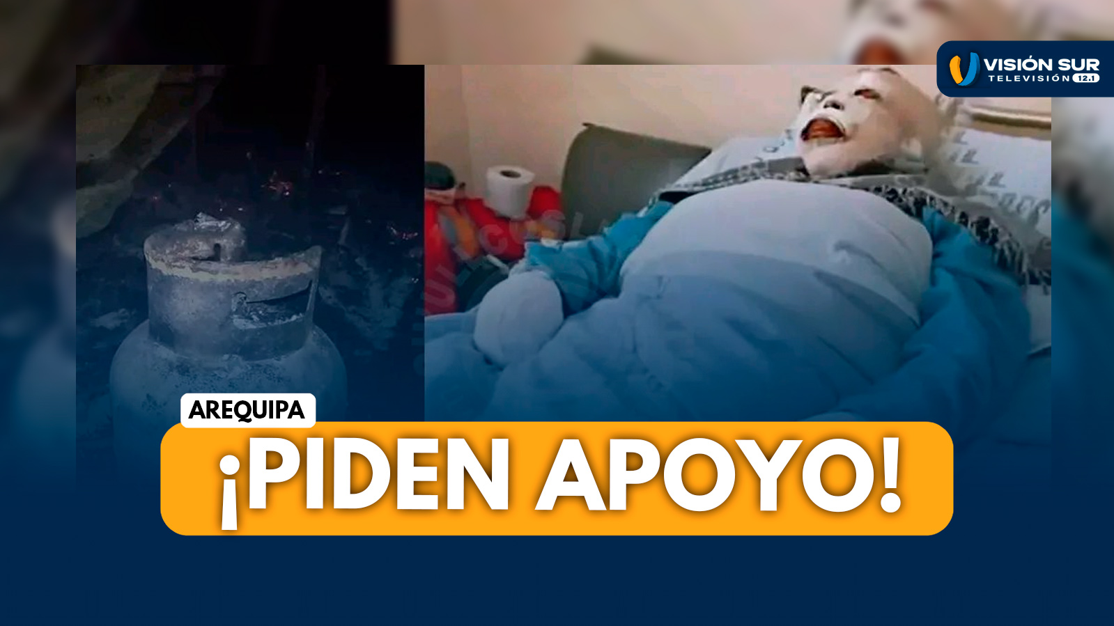 AREQUIPA: EXPLOSIÓN DE BALÓN DE GAS DEJA GRAVE A MADRE DE DOS NIÑOS Y PIDEN APOYO SOLIDARIO