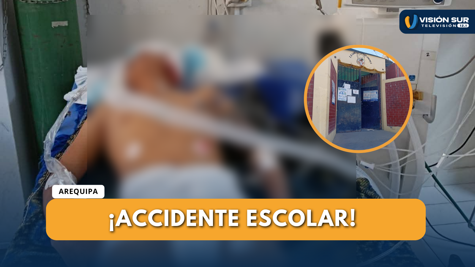 HUANUHUANU: GRAVE ACCIDENTE DEJA A DOS ESCOLARES HERIDOS CUANDO IBAN EN MOTOCICLETA A SU CENTRO DE ESTUDIOS 